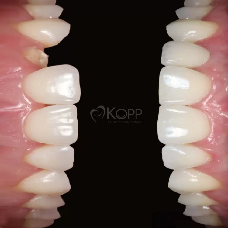 Colagem de antes e depois de tratamentos no Instituto Kopp