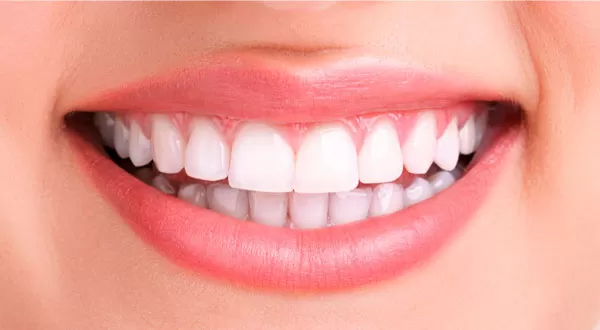Clareamento e odontologia estética no Instituto Kopp em Curitiba