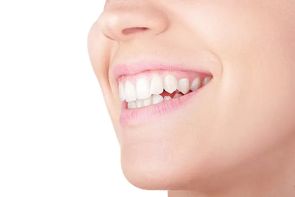 Doença periodontal e inflamação da gengiva